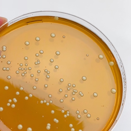 Bacterial imbalance