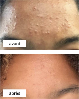avant