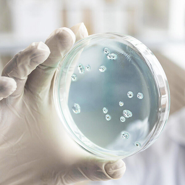 Tumbnail_0001_Bacteriële onbalans 2_RS